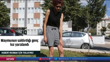 Maymunun saldırdığı gen&ccedil; kız yaralandı