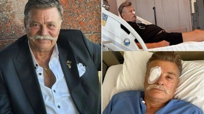 Nuri Al&ccedil;o Bağırsak Tıkanıklığıyla Yeniden Ameliyat Masasına Yatacak