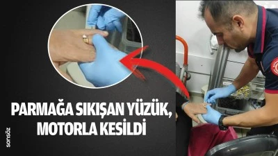 Parmağa sıkışan y&uuml;z&uuml;k, motorla kesildi