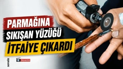 Parmağına sıkışan y&uuml;z&uuml;ğ&uuml; itfaiye &ccedil;ıkardı