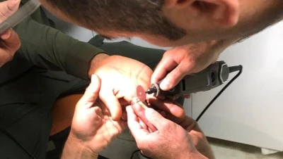 Parmakta sıkışan y&uuml;z&uuml;k itfaiye ekibince hastanede &ccedil;ıkarıldı