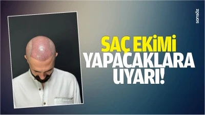Sa&ccedil; ekimi yapacaklara uyarı!