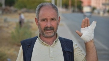 Şanlıurfa Bağlar Mahallesinde K&ouml;pek Saldırısına Uğrayan Yılmaz Hastaneden Taburcu Edildi