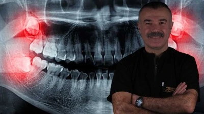 Yirmilik dişler ihmale gelmiyor!