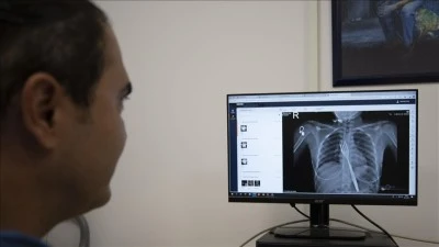 Yuttuğu &ccedil;atal bilimsel makaleye konu olacak