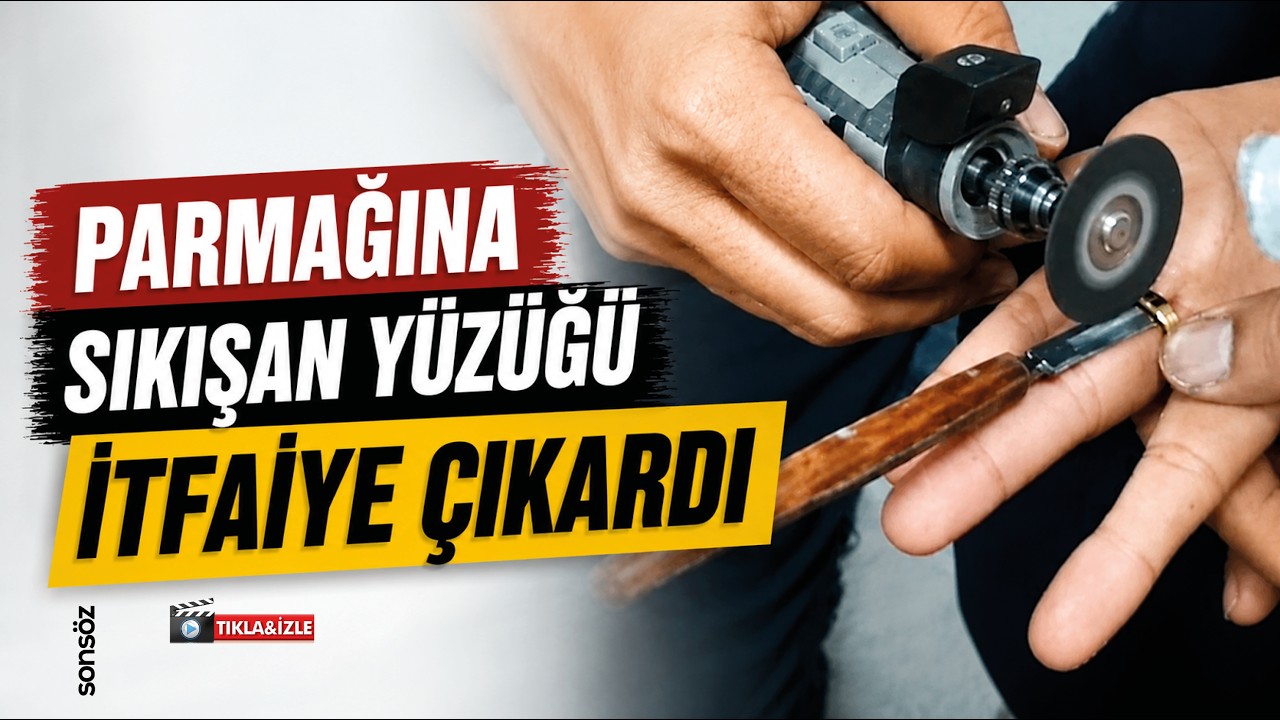 Parmağına sıkışan y&uuml;z&uuml;ğ&uuml; itfaiye &ccedil;ıkardı