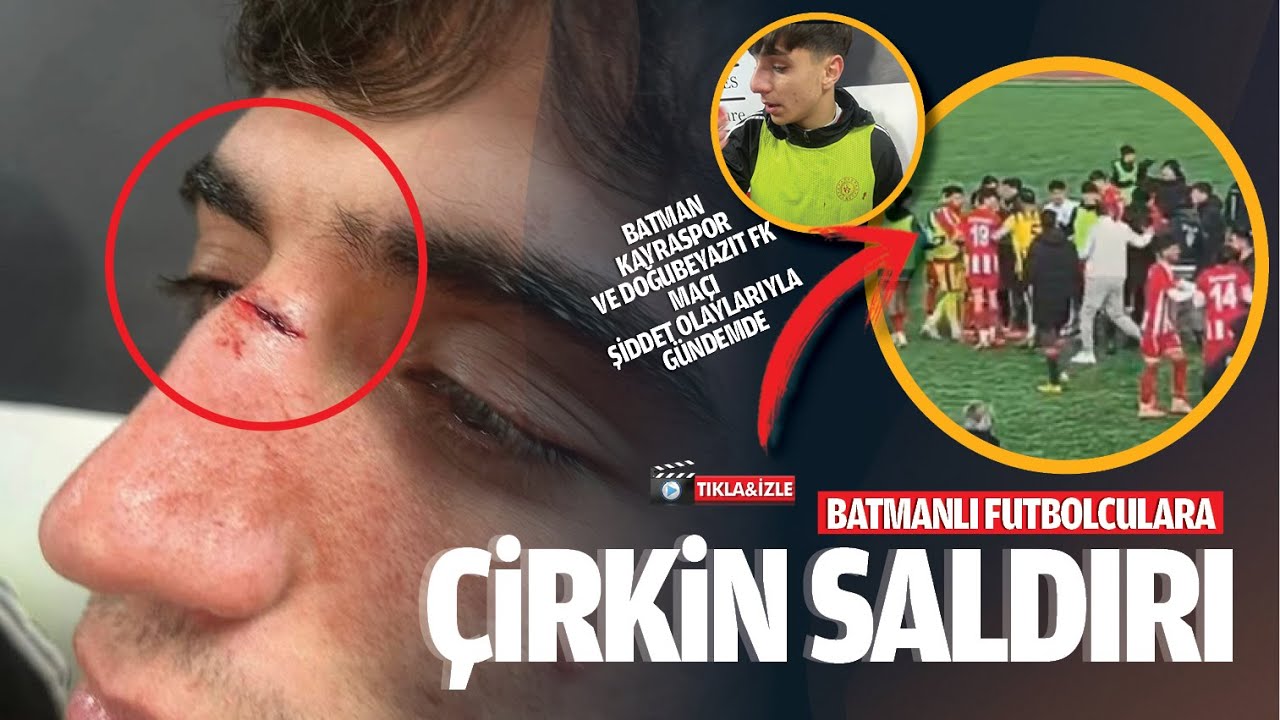 Batmanlı futbolculara &ccedil;irkin saldırı